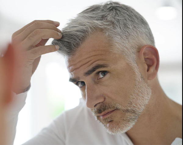 Hair Replacement (2)