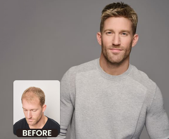 Unveiling Virtual Reality Hair Replacement Technology