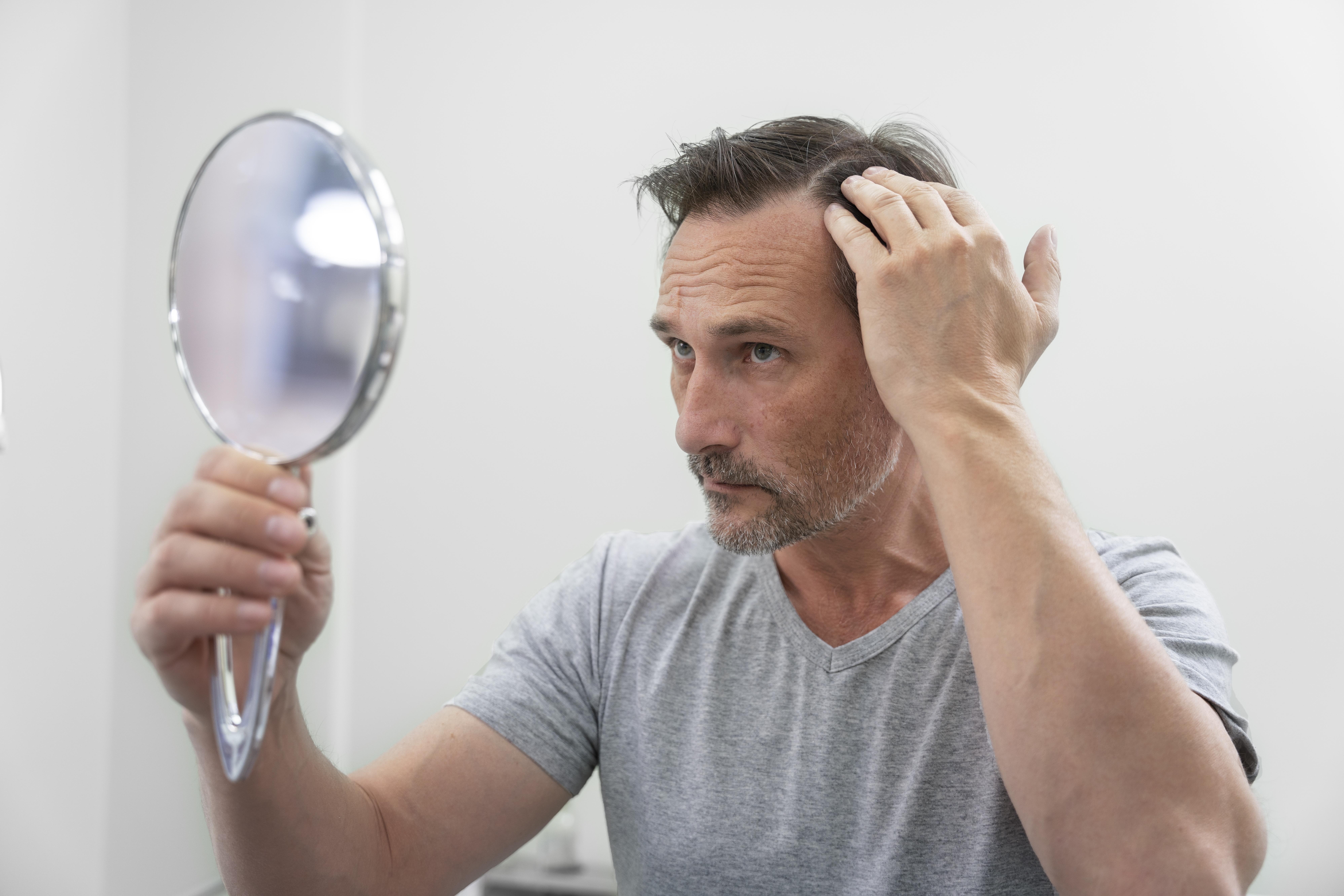 What Should You Expect During a Non-Surgical Hair Restoration Consultation?