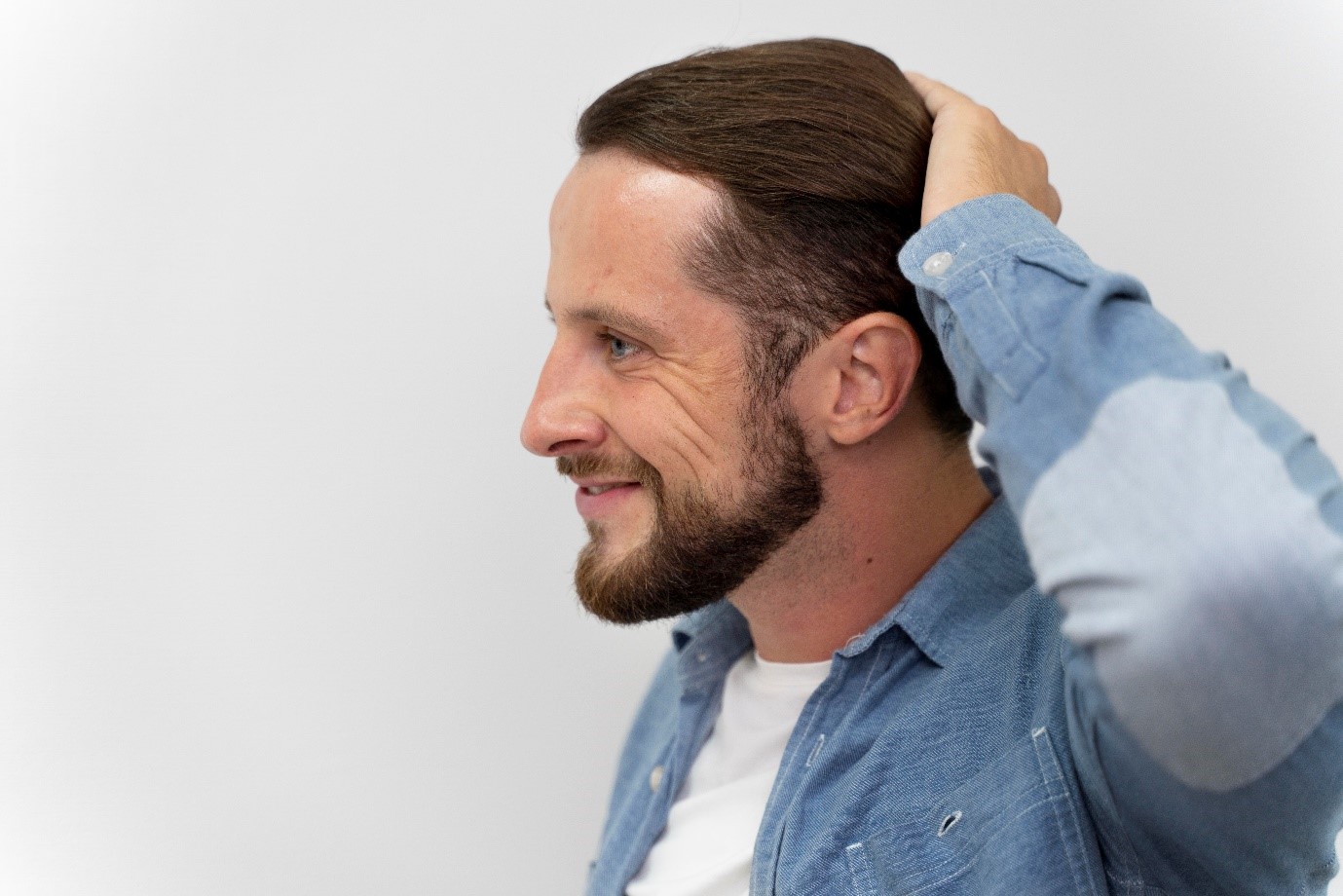Can hair restoration services in Lake Forest fix even the most stubborn hair loss issues?
